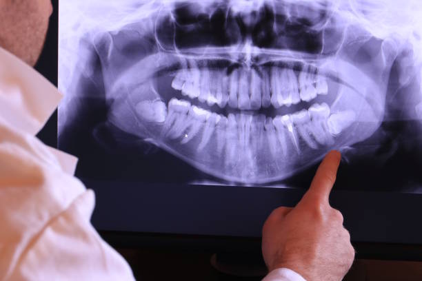 Best Emergency Treatment for Dental Infections or Abscesses in Fairless Hills, PA